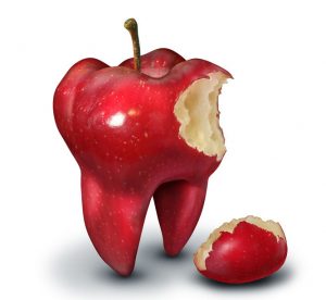 Tooth Crown Pain — Dental Emergencies