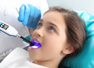 Dental Sealants Placed by Dentist
